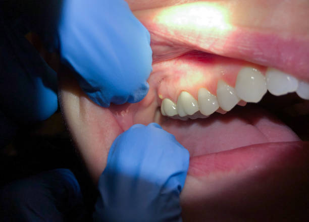 Best Cracked Tooth Emergency Dentist  in Hauula, HI