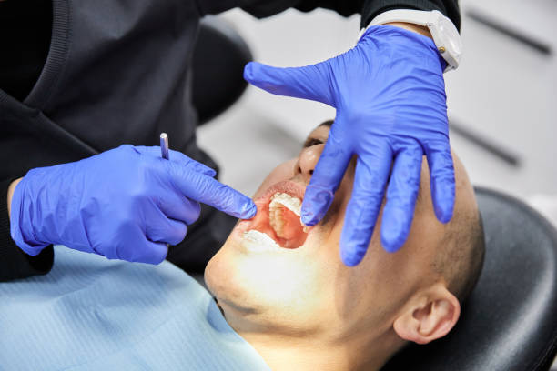 Best Chipped Tooth Repair Near Me  in Hauula, HI